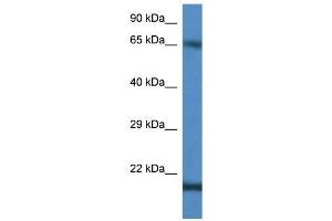 Western Blot showing CTAG1B antibody used at a concentration of 1 ug/ml against Jurkat Cell Lysate (CTAG1B Antikörper  (C-Term))