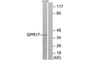 Western blot analysis of extracts from LOVO cells, using GPR17 Antibody.