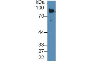 Detection of Plg in Rat Serum using Polyclonal Antibody to Plasminogen (Plg) (PLG Antikörper  (AA 191-433))
