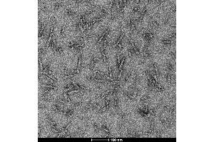 Electron Microscopy (EM) image for Synuclein, alpha (SNCA) (Ala53Thr-Mutant) (Active) protein (ABIN6952303)