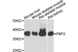 Western blot analysis of extracts of various cells, using FBP2 antibody. (FBP2 Antikörper)