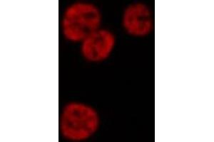 ABIN6268985 staining HeLa cells by IF/ICC. (HNRNPD/AUF1 Antikörper  (pSer83))