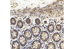 Immunohistochemistry (Paraffin-embedded Sections) (IHC (p)) image for anti-Heat Shock 60kDa Protein 1 (Chaperonin) (HSPD1) antibody (ABIN7074167)