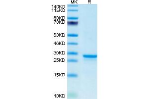 WFDC1 Protein (AA 24-211) (His tag)