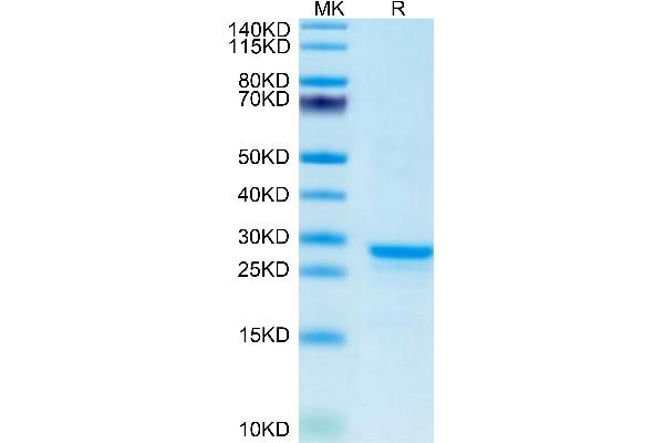 WFDC1 Protein (AA 24-211) (His tag)