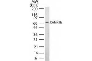 Image no. 1 for anti-Calcium/calmodulin-Dependent Protein Kinase II beta (CAMK2B) (AA 499-513) antibody (ABIN221188) (CAMK2B Antikörper  (AA 499-513))