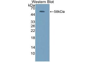 Western blot analysis of the recombinant protein. (FOS Antikörper  (AA 6-240))