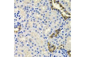Immunohistochemistry of paraffin-embedded mouse kidney using CALB2 antibody.