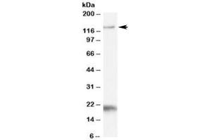Western blot testing of Daudi cell lysate with HTATSF1 antibody at 1ug/ml. (HTATSF1 Antikörper)