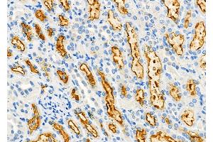 ABIN6263739 and ABIN6277291 at 1/100 staining Rat kidney tissue by IHC-P. (NRP2 Antikörper  (N-Term))