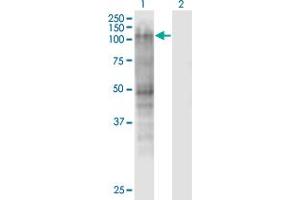 Western Blot analysis of MSH2 expression in transfected 293T cell line by MSH2 monoclonal antibody (M01), clone 2G9. (MSH2 Antikörper  (AA 835-934))