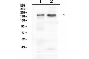 Western blot analysis of IQGAP1 using anti-IQGAP1 antibody (ABIN6719262).