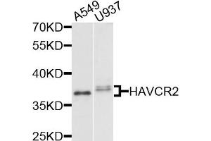 Western blot analysis of extracts of various cells, using HAVCR2 antibody. (TIM3 Antikörper)