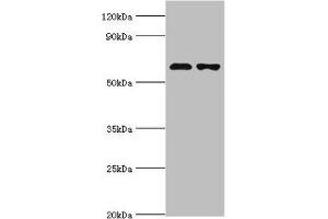 Western blot All lanes: Sterol O-acyltransferase 1 antibody at 2 μg/mL Lane 1: 293T whole cell lysate Lane 2: Jurkat whole cell lysate Secondary Goat polyclonal to rabbit IgG at 1/10000 dilution Predicted band size: 65, 59, 58 kDa Observed band size: 65 kDa (SOAT1 Antikörper  (AA 1-130))