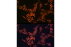 Immunofluorescence analysis of NIH-3T3 cells using ULK3 Rabbit mAb (ABIN7271222) at dilution of 1:100 (40x lens). (ULK3 Antikörper)