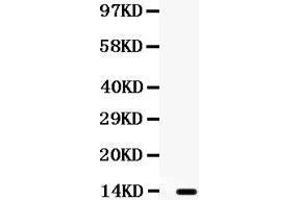 Observed bind size: 13KD (XCL1 Antikörper  (AA 22-114))