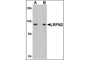 Western blot analysis of LRFN2 in rat brain lysate with this product at (A) 1 and (B) 2 μg/ml. (LRFN2 Antikörper  (C-Term))