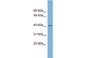 WB Suggested Anti-TFDP3 Antibody Titration: 0. (TFDP3 Antikörper  (Middle Region))