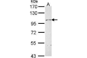 WB Image Sample (30 ug of whole cell lysate) A: Hela 7. (Neuropilin 1 Antikörper  (C-Term))