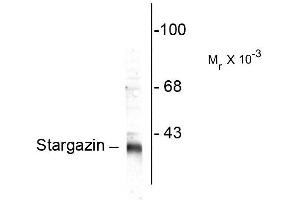 Western blots of rat synaptic membrane (SPM) showing specific immunolabeling of the ~ 36k stargazin protein. (Stargazin Antikörper  (C-Term))