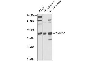 Western blot analysis of extracts of various cell lines, using TIMM50 antibody (ABIN6132725, ABIN6149170, ABIN6149171 and ABIN6225341) at 1:1000 dilution. (TIMM50 Antikörper  (AA 190-456))