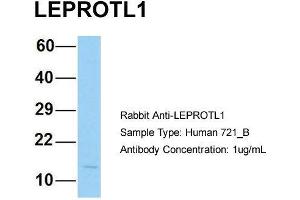 Western Blotting (WB) image for anti-Leptin Receptor Overlapping Transcript-Like 1 (LEPROTL1) (N-Term) antibody (ABIN2790809)