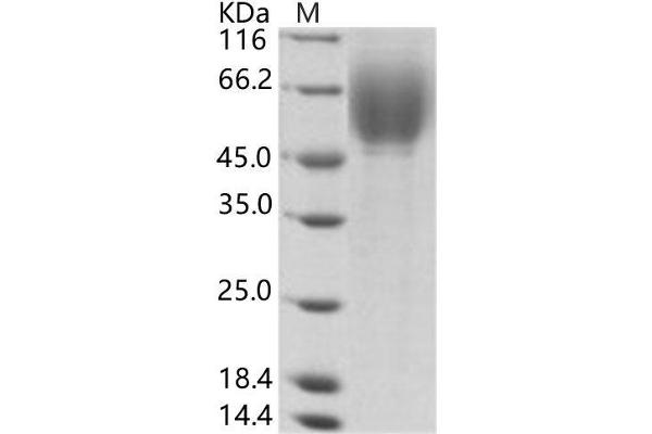 HCV E2 Protein (His tag)