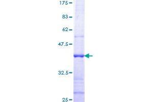 TMPRSS2 Protein (AA 383-492) (GST tag)