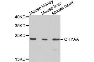 Western blot analysis of extracts of mouse tissues, using CRYAA antibody.