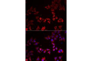 Immunofluorescence analysis of A549 cell using LIMS1 antibody. (LIMS1 Antikörper)