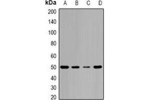 Western blot analysis of Pontin 52 expression in MCF7 (A), HepG2 (B), mouse spleen (C), mouse brain (D) whole cell lysates. (RUVBL1 Antikörper)