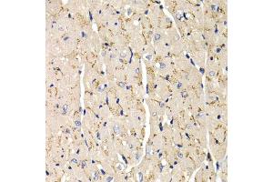 Immunohistochemistry of paraffin-embedded mouse heart using SFRP2 antibody (ABIN5973117) at dilution of 1/200 (40x lens). (SFRP2 Antikörper)