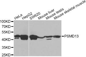 Western blot analysis of extracts of various cell lines, using PSMD13 Antibody. (PSMD13 Antikörper)