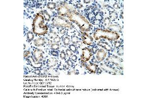 Rabbit Anti-ZESR2 Antibody  Paraffin Embedded Tissue: Human Kidney Cellular Data: Epithelial cells of renal tubule Antibody Concentration: 4. (ZRSR2 Antikörper  (C-Term))