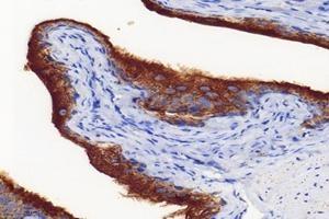 Immunohistochemistry analysis of paraffin-embedded mouse bladder using,Uroplakin Ia (ABIN7076160) at dilution of 1: 4000