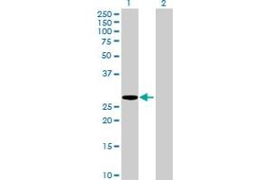 Western Blot analysis of HLA-DMA expression in transfected 293T cell line by HLA-DMA MaxPab polyclonal antibody. (HLA-DMA Antikörper  (AA 1-261))