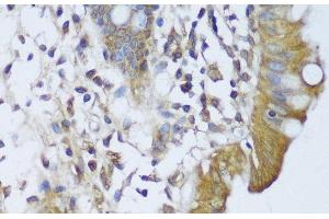 Immunohistochemistry of paraffin-embedded Human colon using GCN1L1 Polyclonal Antibody at dilution of 1:150 (40x lens). (GCN1L1 Antikörper)