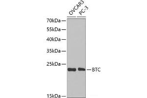 Western blot analysis of extracts of various cell lines using BTC Polyclonal Antibody at dilution of 1:1000. (Betacellulin Antikörper)