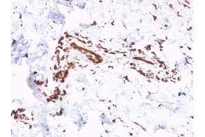 Formalin-fixed, paraffin-embedded human Skin stained with Collagen VII Mouse Monoclonal Antibody (LH7.