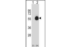 Western blot analysis of CD33 (arrow) using rabbit polyclonal CD33 Antibody (Center) (ABIN657464 and ABIN2846492). (CD33 Antikörper  (AA 88-117))