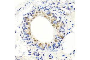 Immunohistochemistry of paraffin-embedded mouse lung using ENDOG antibody (ABIN5997672) at dilution of 1/100 (40x lens). (Endonuclease G Antikörper)