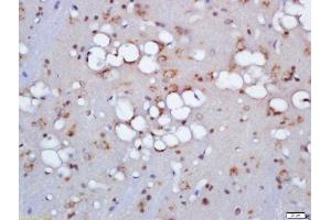 Formalin-fixed and paraffin embedded rat brain labeled with Anti-ZNRF3 Polyclonal Antibody, Unconjugated  at 1:200 followed by conjugation to the secondary antibody and DAB staining (ZNRF3 Antikörper  (AA 120-165))