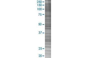 CXCR4 transfected lysate.
