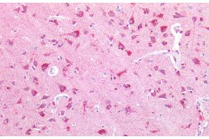 Immunohistochemistry of paraffin-embedded Human adrenal tissue using NPTX1 Polyclonal Antibody at dilution of 1:100.