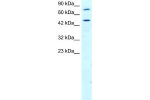 WB Suggested Anti-RGS9 Antibody Titration:  2. (RGS Antikörper  (N-Term))