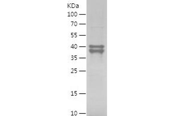 MDM2 Protein (AA 1-300) (His tag)