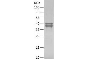 MDM2 Protein (AA 1-300) (His tag)