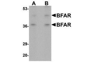 Western blot analysis of BFAR in human kidney tissue lysate with AP30141PU-N BFAR antibody at (A) 1 and (B) 2 μg/ml.