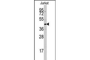 Western blot analysis of PTPN7 polyclonal antibody  in Jurkat cell line lysates (35 ug/lane). (PTPN7 Antikörper  (Ser44))