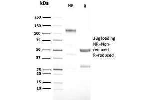 SDS-PAGE Analysis Purified G-CSF Recombinant Rabbit Monoclonal Antibody (CSF3/3166R). (Rekombinanter G-CSF Antikörper)